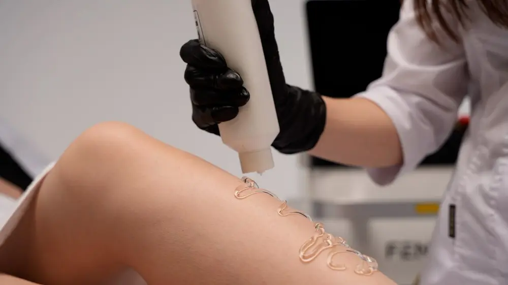 Laser handpiece above the leg with gel applied